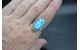 Kingman turquoise ring